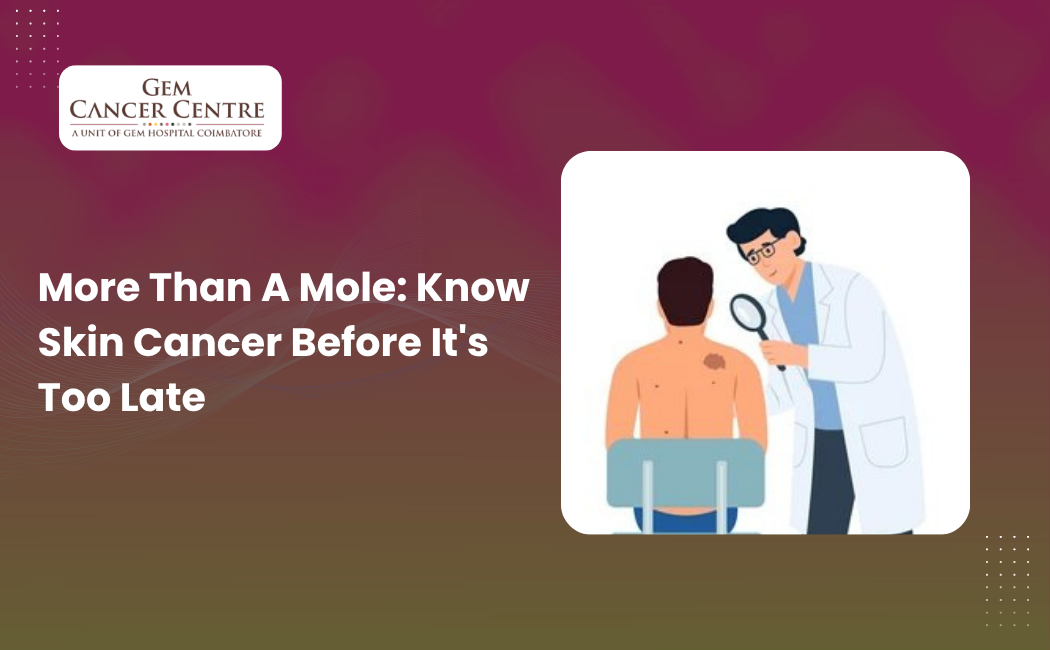 Early signs of skin cancer mole changes on skin awareness guide